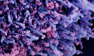 #ZacharyStieber Of The #EpochTimes Via #ZeroHedge: Natural Immunity Better Than Protection From COVID-19 Vaccination: Study